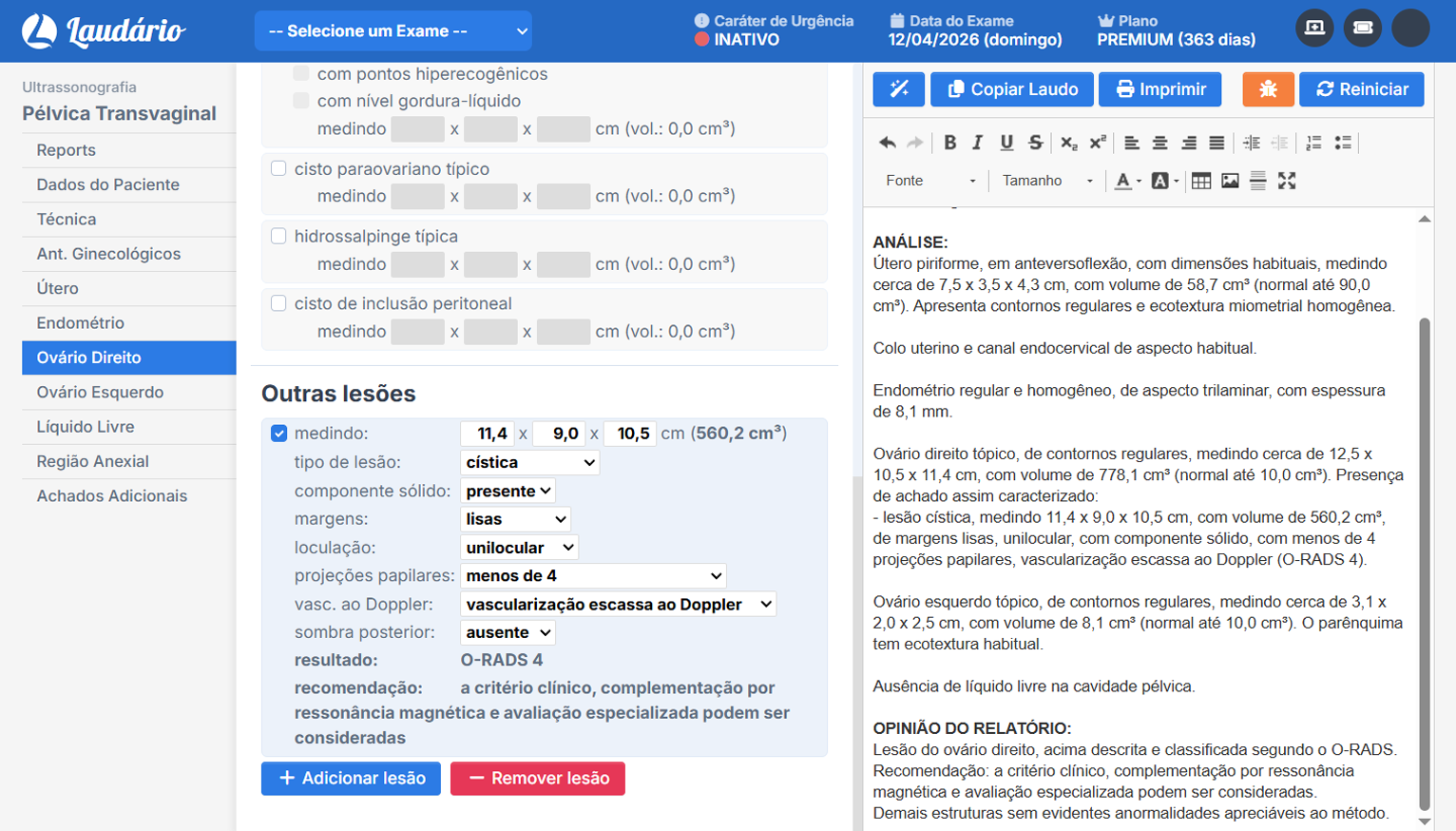 Classificação automática O-RADS